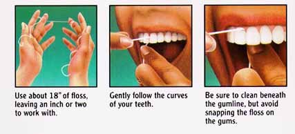 http://www.qualitydentistry.com/dental/ecare/flossing.gif